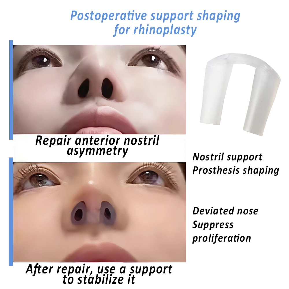 Postoperative Rhinoplasty Nost - đánh giá và giá Anti Snore Contour Pillow